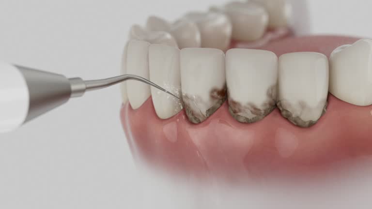 Reliable Dental Implants contractor in St. James, NC by Smile Center Dentistry